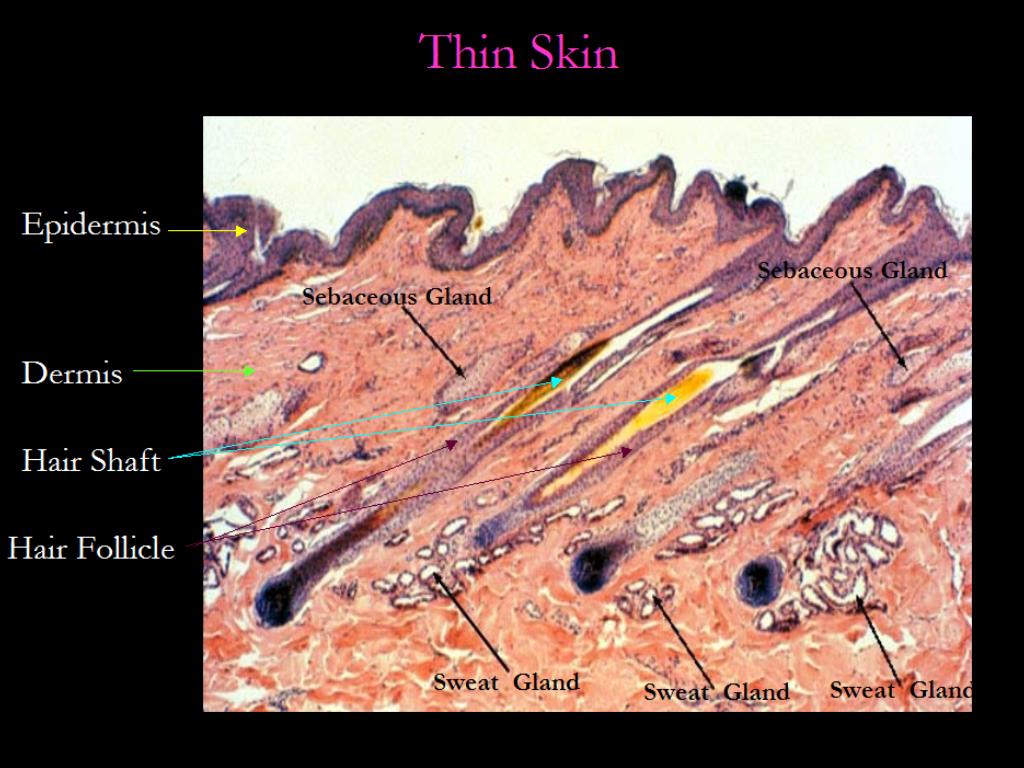 photomicrograph-of-thin-skin-labeled-my-xxx-hot-girl